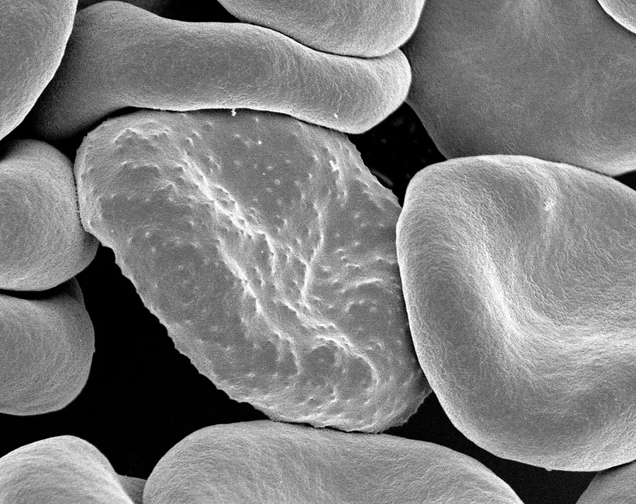 An illustration of doughnut-shaped red blood cells carrying oxygen