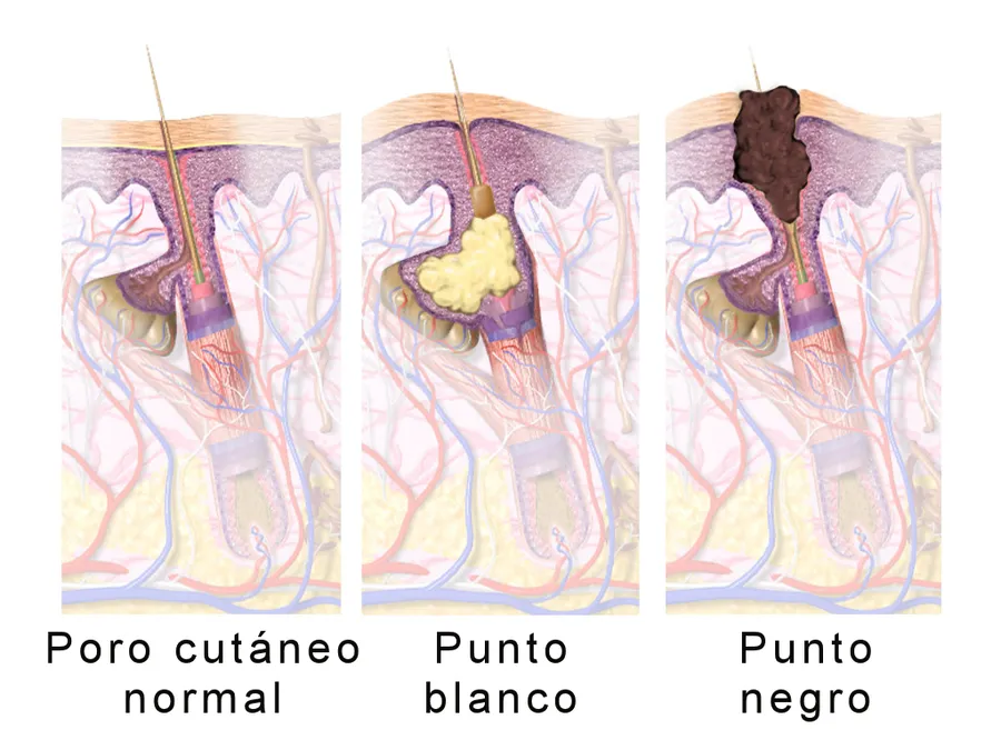 An illustration of a hair follicle growing a strand of hair