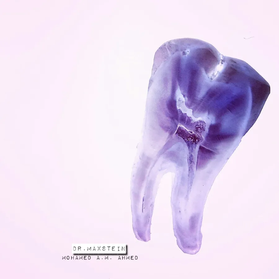 A cross-section diagram of a tooth showing enamel and pulp layers