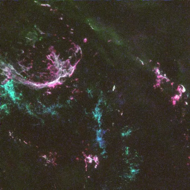 A giant star exploding as a supernova, scattering elements into space